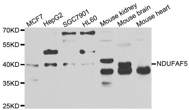 NDUFAF5 Antibody in Western Blot (WB)