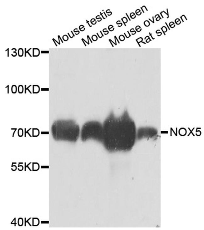 NOX5 Antibody in Western Blot (WB)