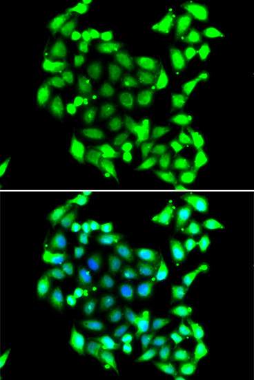 GTF2H3 Antibody in Immunocytochemistry (ICC/IF)