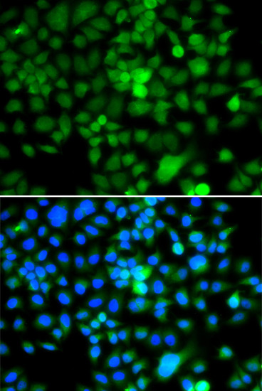 NAP1L3 Antibody in Immunocytochemistry (ICC/IF)