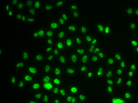 PHIP Antibody in Immunocytochemistry (ICC/IF)