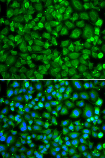 SAT2 Antibody in Immunocytochemistry (ICC/IF)