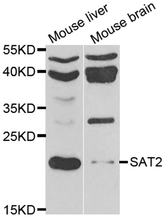 SAT2 Antibody in Western Blot (WB)