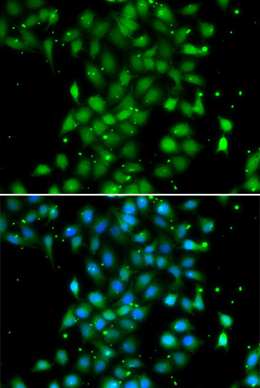 UBE2Z Antibody in Immunocytochemistry (ICC/IF)