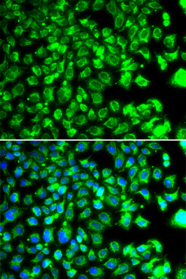 C10orf32 Antibody in Immunocytochemistry (ICC/IF)