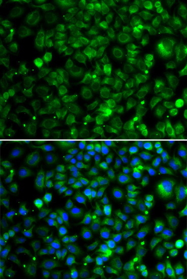 TMLHE Antibody in Immunocytochemistry (ICC/IF)