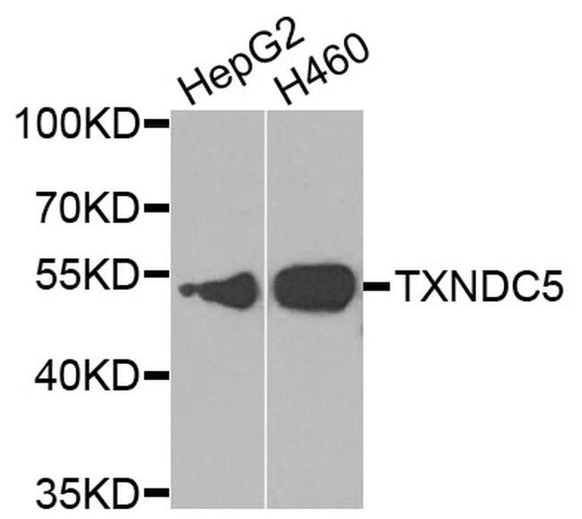 TXNDC5 Antibody in Western Blot (WB)