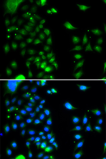 UBE2J2 Antibody in Immunocytochemistry (ICC/IF)