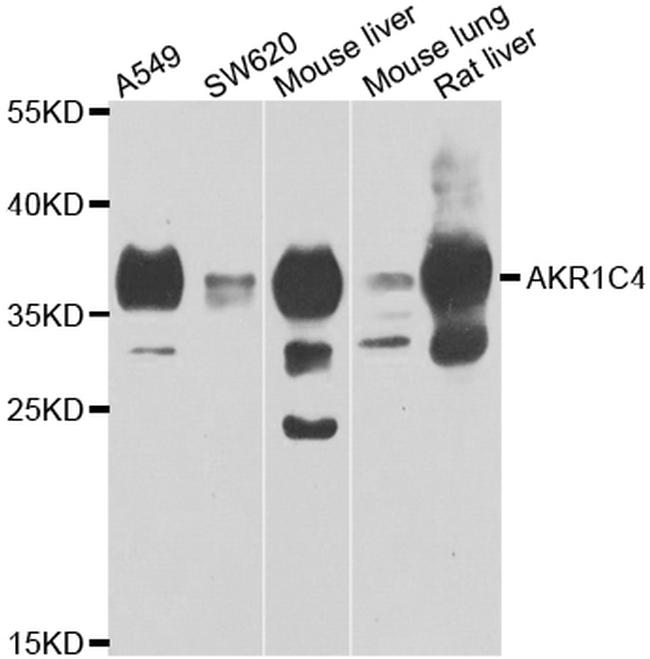 AKR1C4 Antibody in Western Blot (WB)