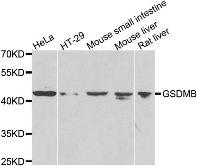 GSDMB Antibody in Western Blot (WB)