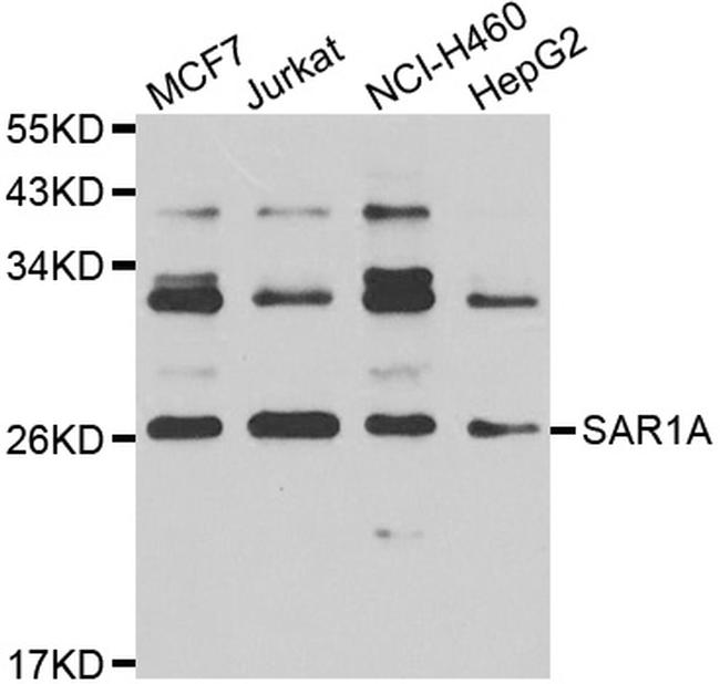 SAR1A Antibody in Western Blot (WB)