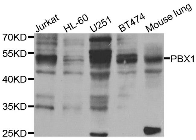 PBX1 Antibody in Western Blot (WB)