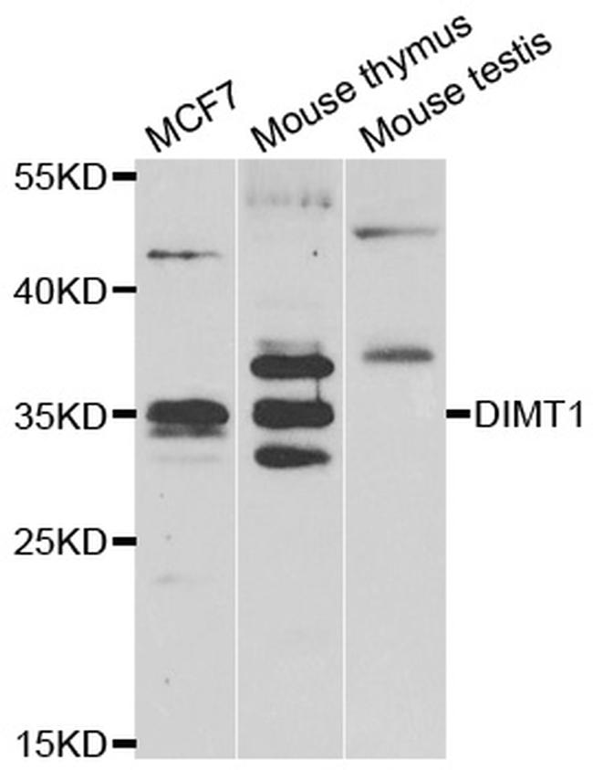 DIMT1 Antibody in Western Blot (WB)