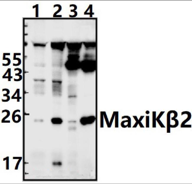 KCNMB2 Antibody in Western Blot (WB)