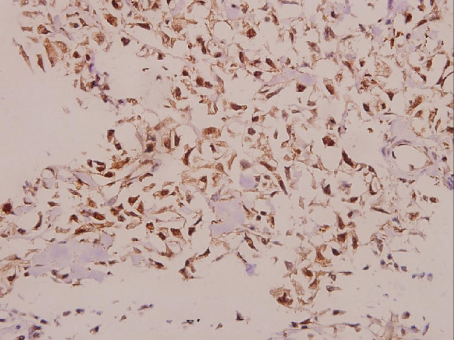 NDUFS5 Antibody in Immunohistochemistry (Paraffin) (IHC (P))