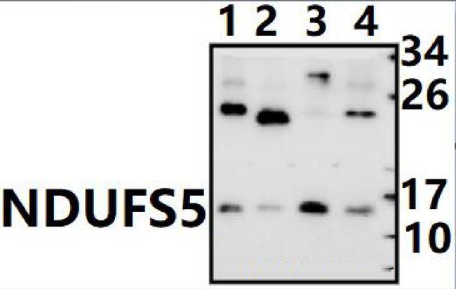 NDUFS5 Antibody in Western Blot (WB)