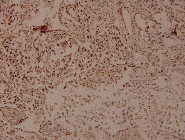 THOC5 Antibody in Immunohistochemistry (Paraffin) (IHC (P))