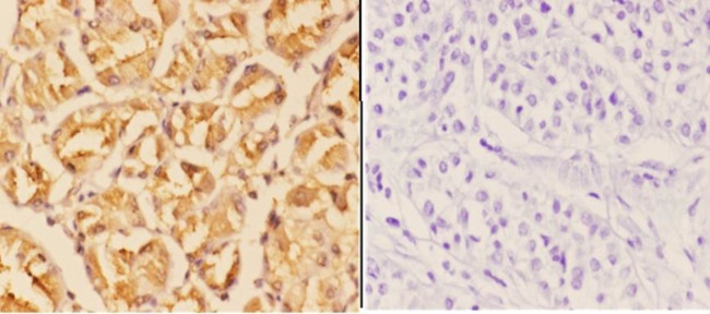 WIPF1 Antibody in Immunohistochemistry (Paraffin) (IHC (P))