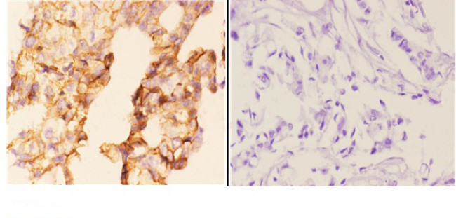 WIPF1 Antibody in Immunohistochemistry (Paraffin) (IHC (P))