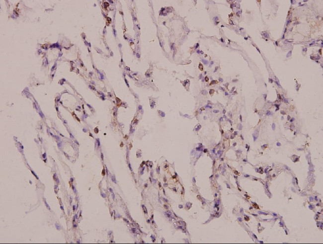 MATK Antibody in Immunohistochemistry (Paraffin) (IHC (P))