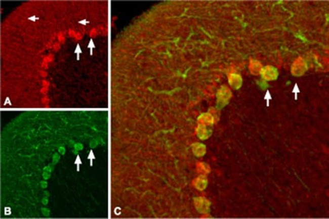 proBDNF Antibody in Immunohistochemistry (IHC)