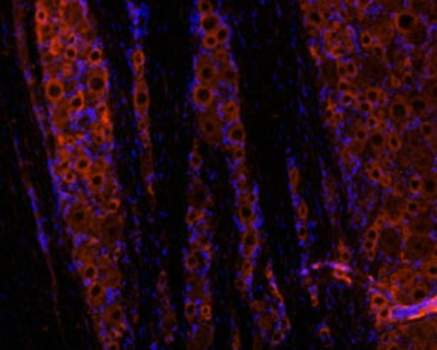 GDNF Antibody in Immunohistochemistry (Frozen) (IHC (F))