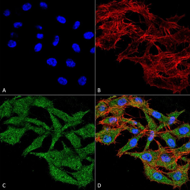 WDFY3 Antibody in Immunocytochemistry (ICC/IF)