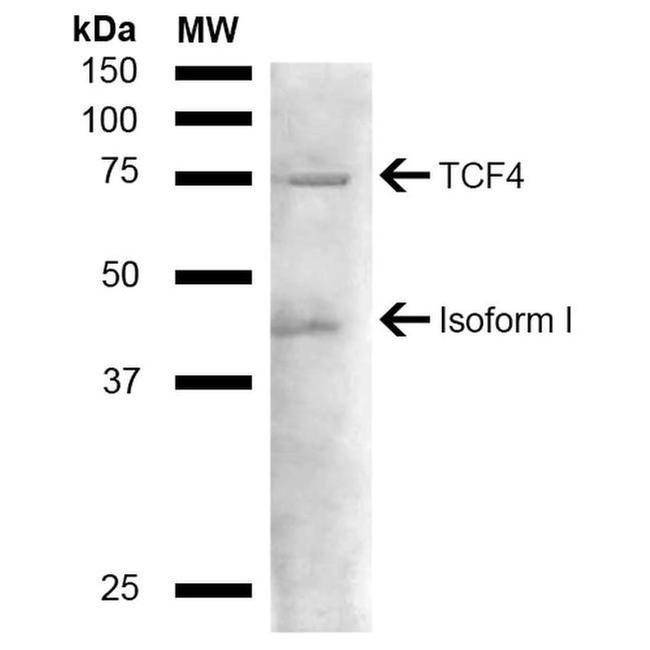 TCF4 Antibody in Western Blot (WB)