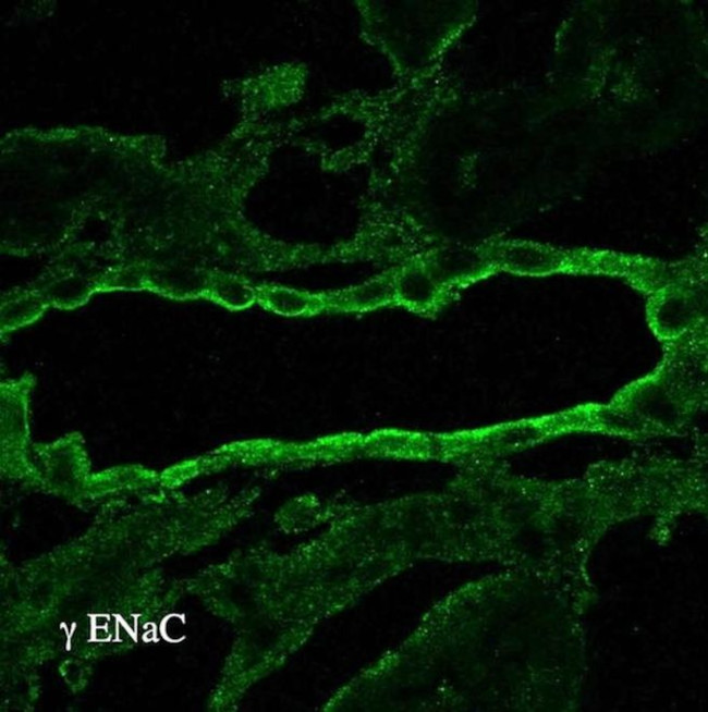 SCNN1G Antibody in Immunohistochemistry (IHC)