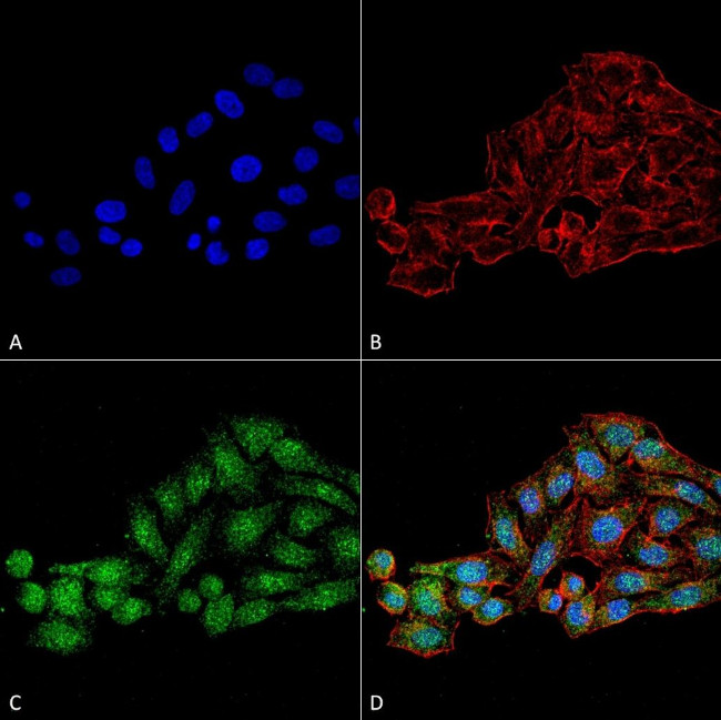 WDR45 Antibody in Immunocytochemistry (ICC/IF)