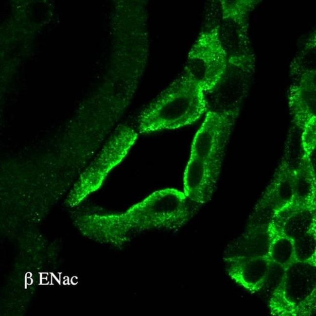 SCNN1B Antibody in Immunohistochemistry (IHC)