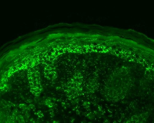 HSPE1 Antibody in Immunohistochemistry (IHC)