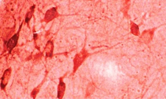 HO-1 Antibody in Immunohistochemistry (IHC)