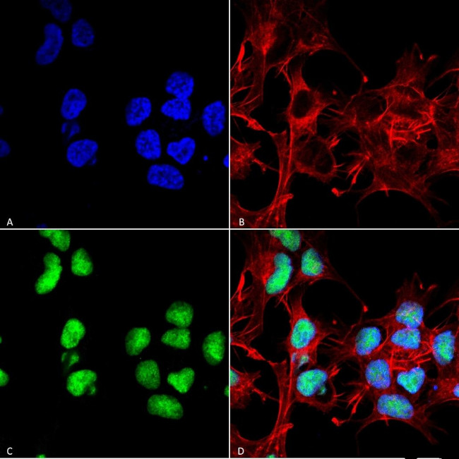 ChAT Antibody in Immunocytochemistry (ICC/IF)