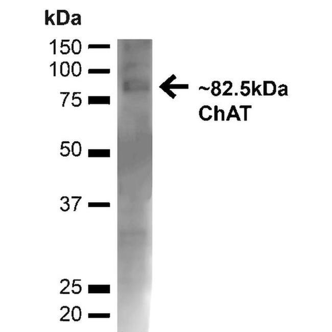 ChAT Antibody in Western Blot (WB)