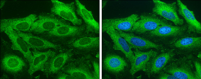 Acetyl-CoA Carboxylase Antibody in Immunocytochemistry (ICC/IF)