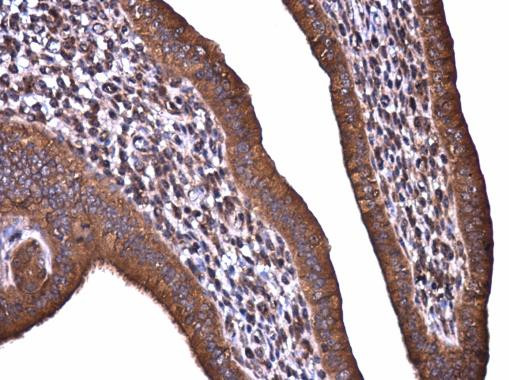 Acetyl-CoA Carboxylase Antibody in Immunohistochemistry (Paraffin) (IHC (P))