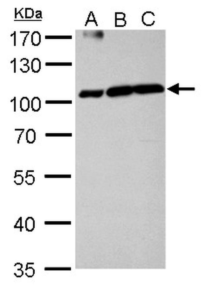 Aconitase 1 Antibody in Western Blot (WB)