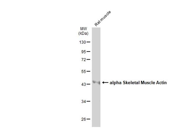 Skeletal Muscle Actin Antibody in Western Blot (WB)