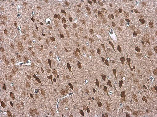 ADORA2B Antibody in Immunohistochemistry (Paraffin) (IHC (P))