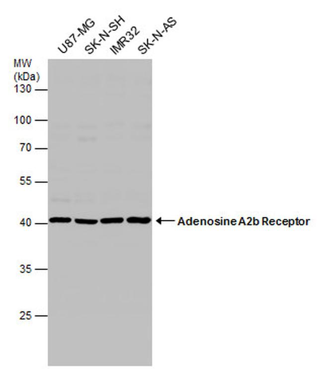 ADORA2B Antibody in Western Blot (WB)