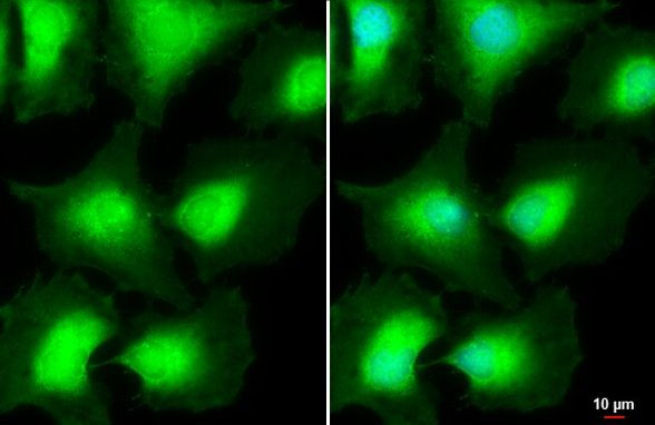 AKT Pan Antibody in Immunocytochemistry (ICC/IF)