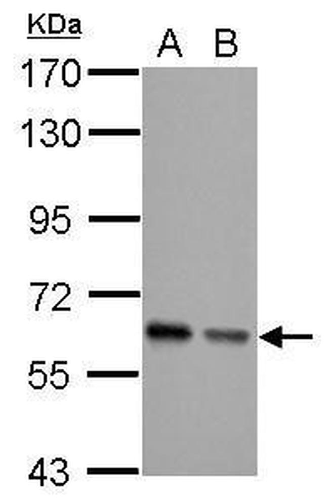 AKT Pan Antibody in Western Blot (WB)