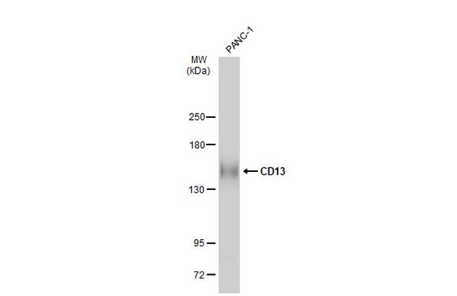 CD13 Antibody in Western Blot (WB)