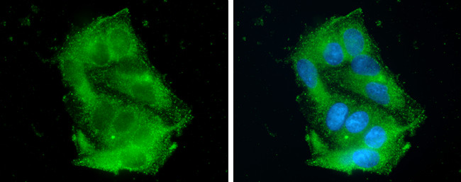 ApoC3 Antibody in Immunocytochemistry (ICC/IF)