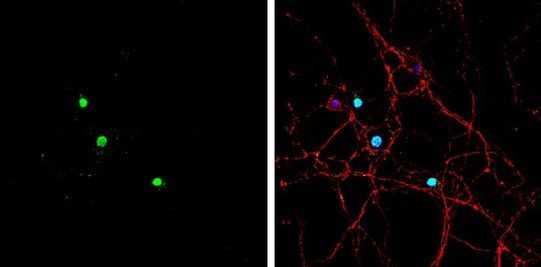 ASCL1 Antibody in Immunocytochemistry (ICC/IF)