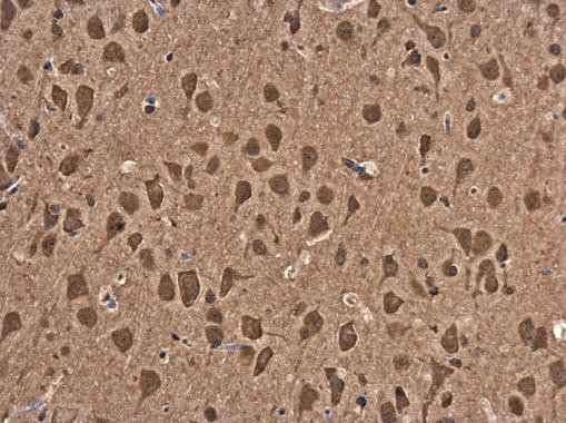 ASCL1 Antibody in Immunohistochemistry (Paraffin) (IHC (P))