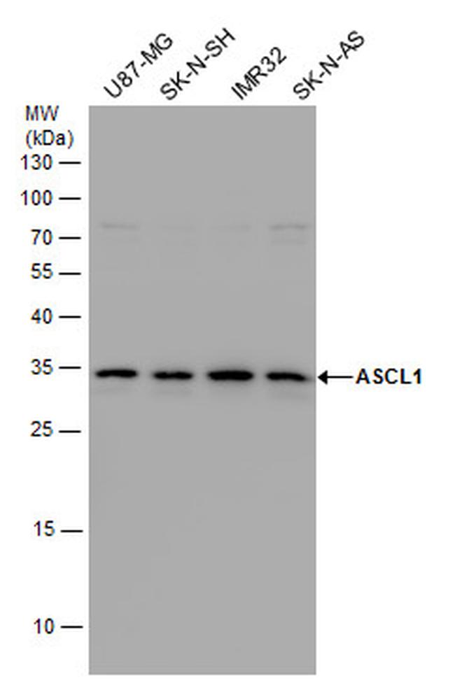 ASCL1 Antibody in Western Blot (WB)