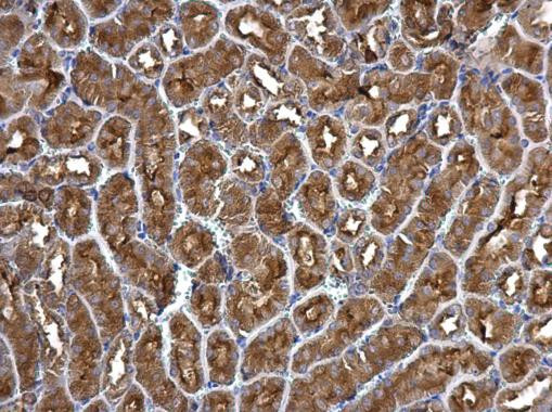 ATP6V1B2 Antibody in Immunohistochemistry (Paraffin) (IHC (P))