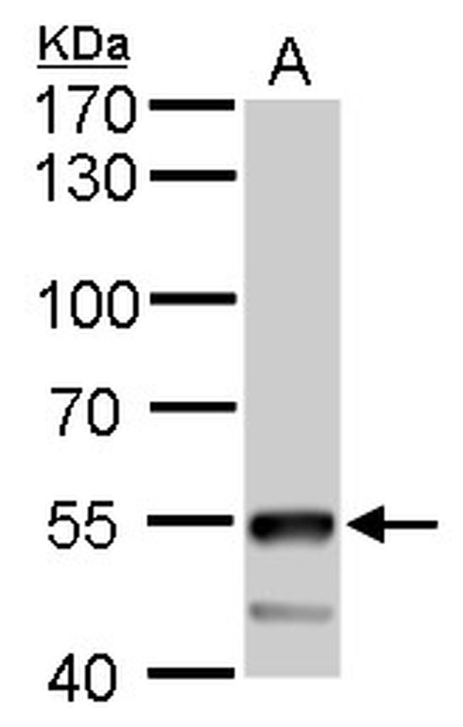 ATP6V1B2 Antibody in Western Blot (WB)